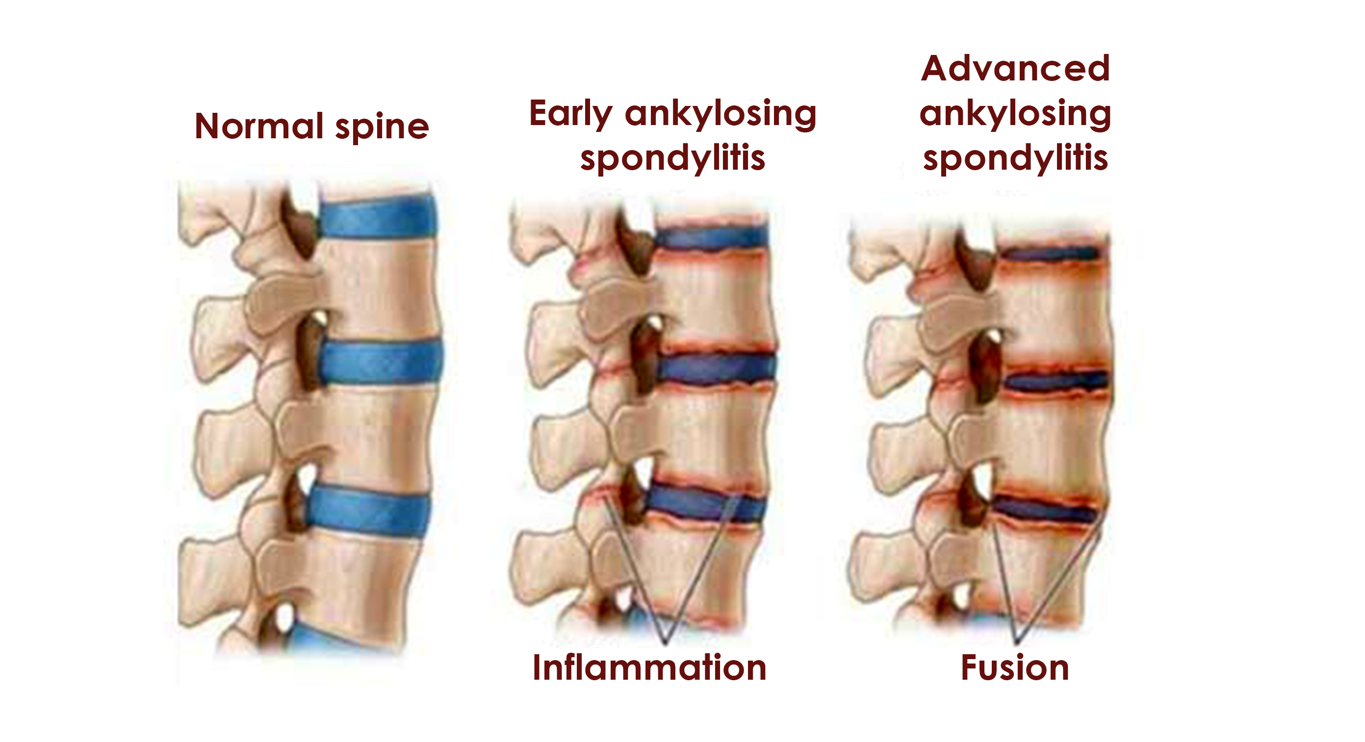 normal spine