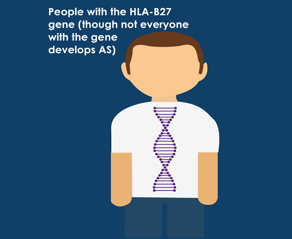 people with the HLA-B27 gene