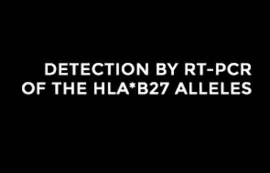  HLA B27