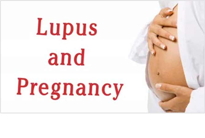 Lupus & Pregnancy