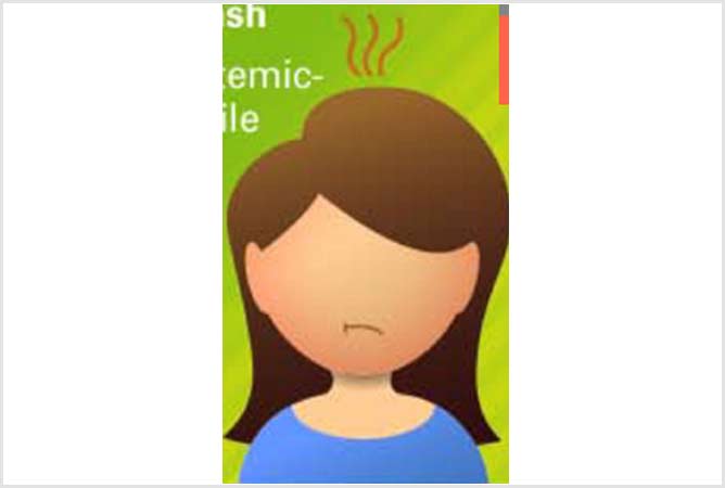 Systemic Onset JIA (SOJIA / Stills disease)