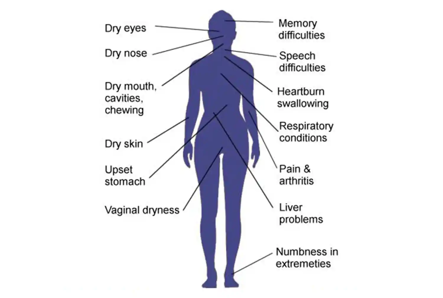 Signs & Symptoms of Sjogren Syndrome