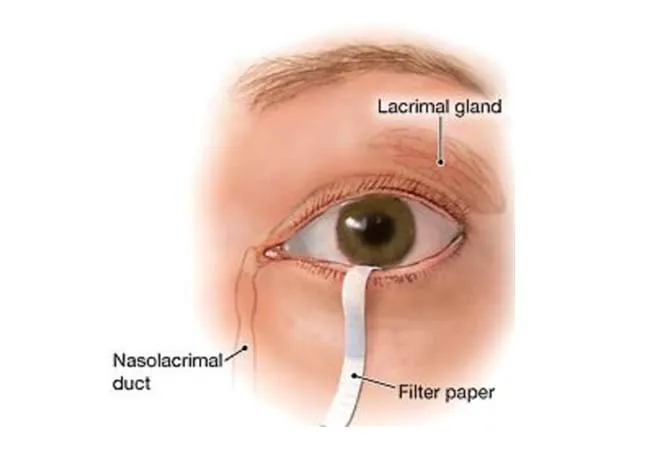 Nasolacrimal Duct