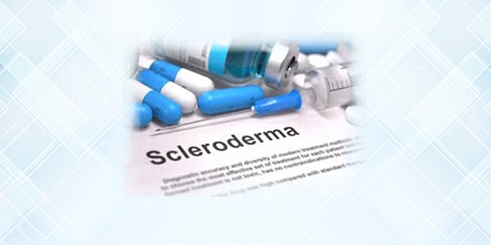 Scleroderma Diagnose