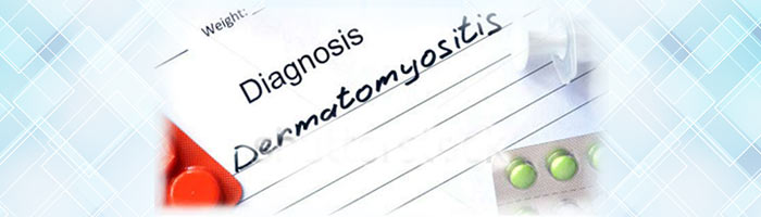 dermatomyositis be diagnosed