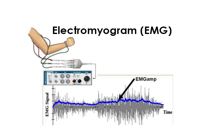 electromyogram